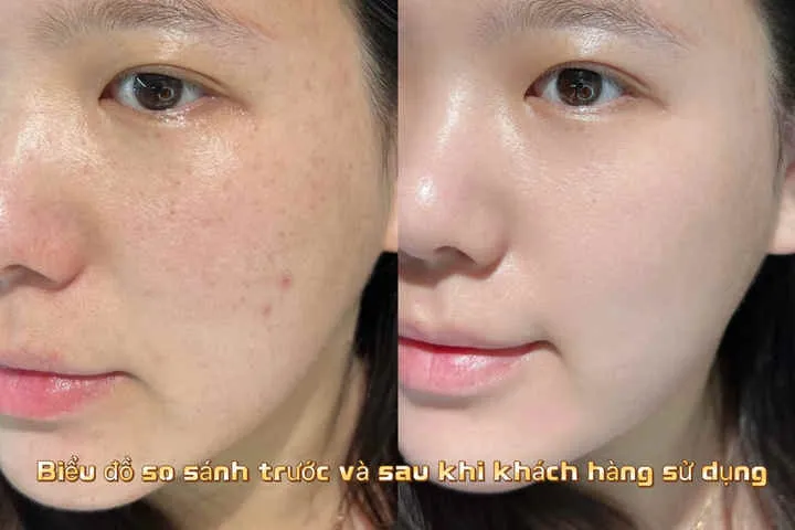 Danxuenilan Elegant Skin Whitening-مجموعة دانكسوينيلان